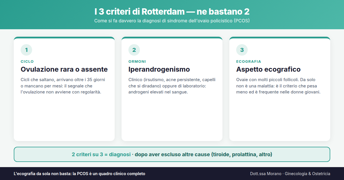Infografica sui 3 criteri di Rotterdam per la diagnosi di PCOS: ovulazione rara o assente, iperandrogenismo clinico o di laboratorio, aspetto ecografico delle ovaie. Ne bastano 2 su 3, dopo aver escluso altre cause.